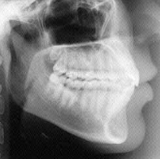 Radiologia Odontológica em Itaboraí
